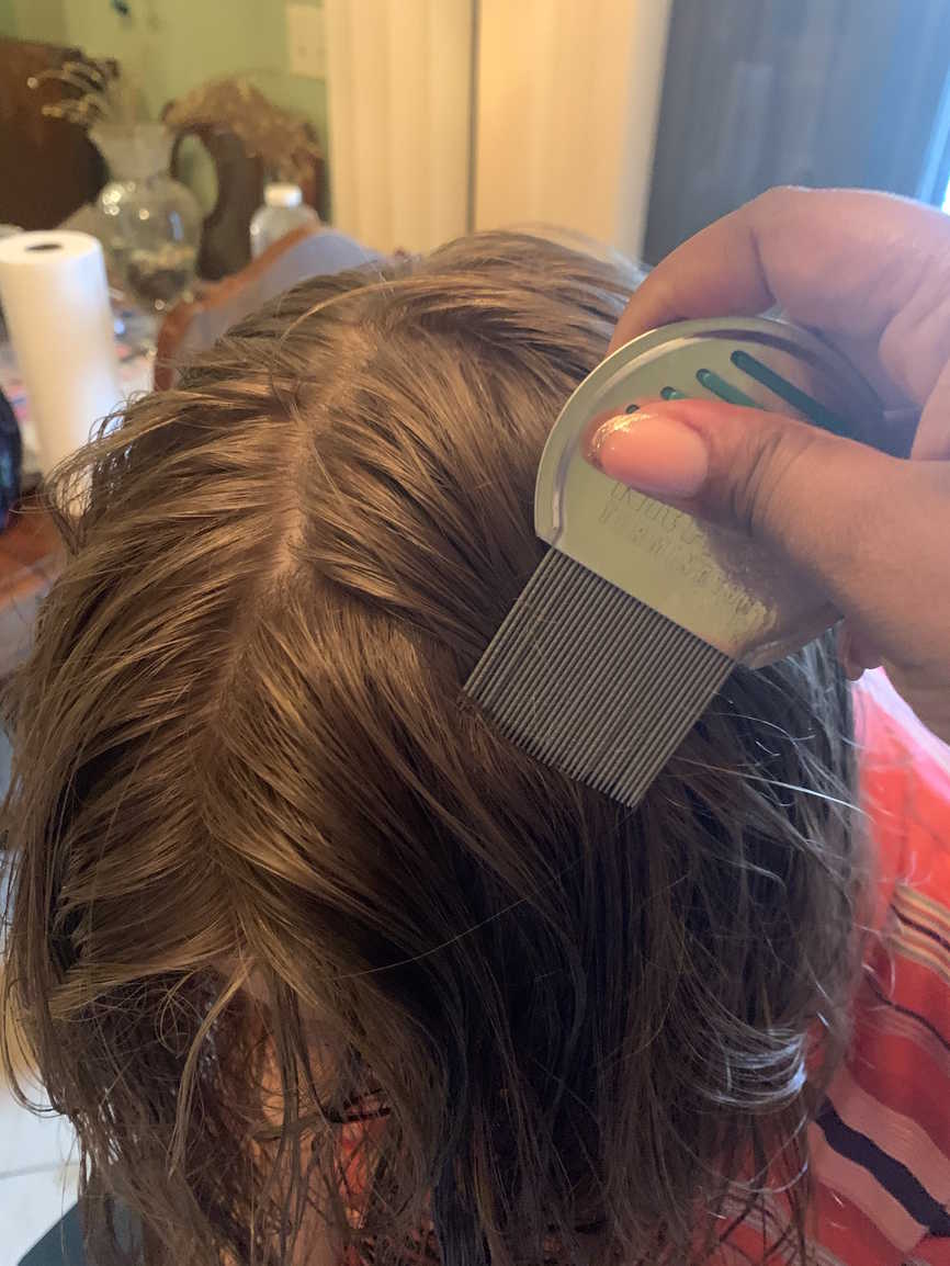 Greenville, South Carolina Head lice treatment & Mobile (inhome